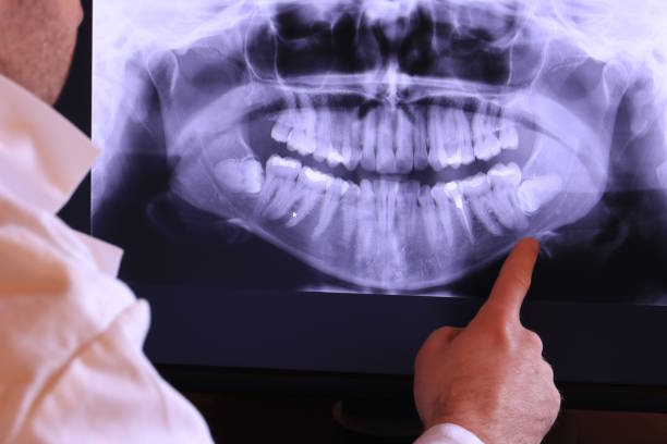 Best Emergency Dental Care for Abscessed Tooth in Bridgeport, MI