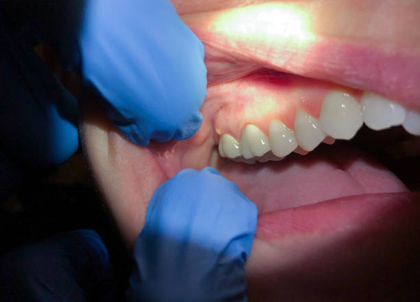 Best Pediatric Emergency Dentist in Bridgeport, MI