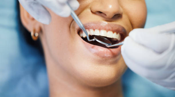 Best Emergency Dentist for Lost Fillings or Crowns in Bridgeport, MI