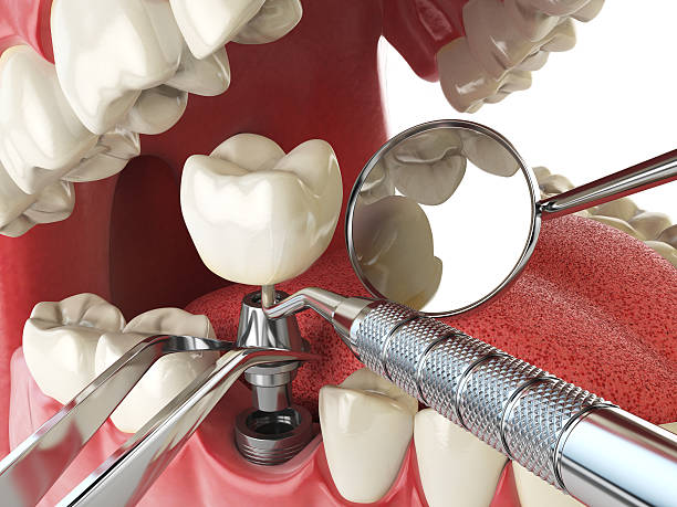 Best Emergency Cosmetic Dentistry in Bridgeport, MI