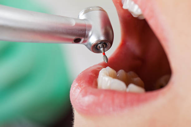 Best Mobile Emergency Dentist in Bridgeport, MI